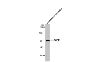 Anti-VCP antibody [HL3018] used in Western Blot (WB). GTX640431
