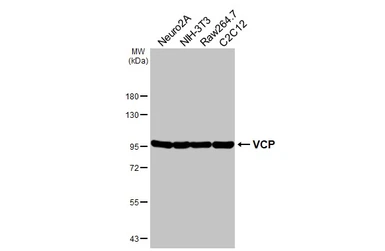 Anti-VCP antibody [HL3018] used in Western Blot (WB). GTX640431