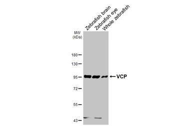 Anti-VCP antibody [HL3018] used in Western Blot (WB). GTX640431