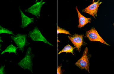 Anti-VCP antibody [HL3018] used in Immunocytochemistry/ Immunofluorescence (ICC/IF). GTX640431
