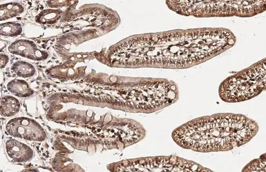 Anti-VCP antibody [HL3018] used in IHC (Paraffin sections) (IHC-P). GTX640431