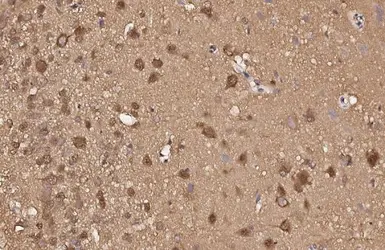 Anti-VCP antibody [HL3018] used in IHC (Paraffin sections) (IHC-P). GTX640431