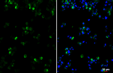 Anti-CCR1 antibody [HL3023] used in Immunocytochemistry/ Immunofluorescence (ICC/IF). GTX640436