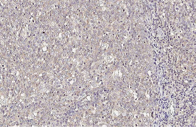 Anti-CCR1 antibody [HL3023] used in IHC (Paraffin sections) (IHC-P). GTX640436