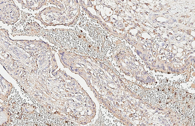 Anti-CCR1 antibody [HL3023] used in IHC (Paraffin sections) (IHC-P). GTX640436