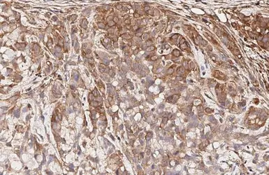 Anti-CCR1 antibody [HL3023] used in IHC (Paraffin sections) (IHC-P). GTX640436
