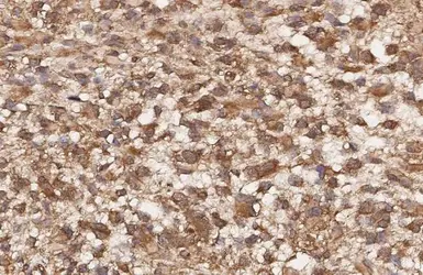 Anti-CCR1 antibody [HL3023] used in IHC (Paraffin sections) (IHC-P). GTX640436