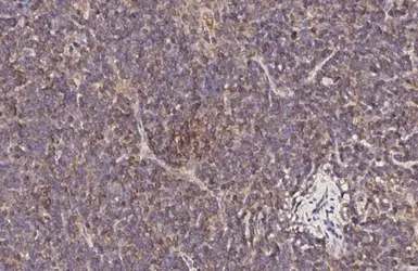Anti-CCR1 antibody [HL3023] used in IHC (Paraffin sections) (IHC-P). GTX640436