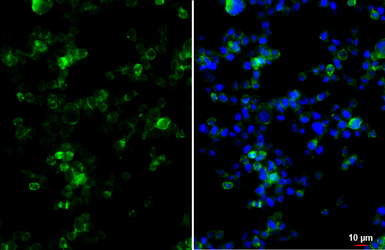 Anti-CCR1 antibody [HL3034] used in Immunocytochemistry/ Immunofluorescence (ICC/IF). GTX640472