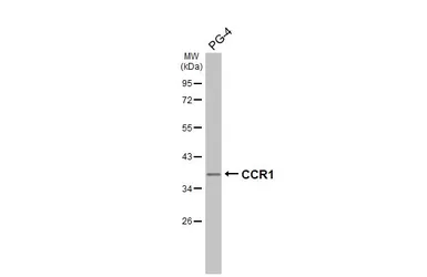 Anti-CCR1 antibody [HL3034] used in Western Blot (WB). GTX640472