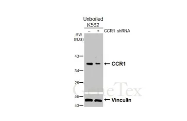 Anti-CCR1 antibody [HL3034] used in Western Blot (WB). GTX640472