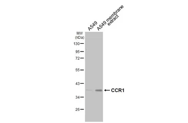 Anti-CCR1 antibody [HL3034] used in Western Blot (WB). GTX640472