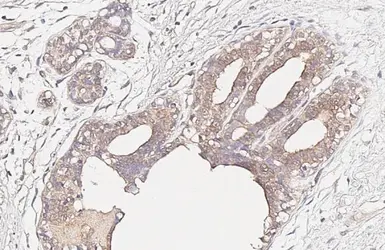 Anti-CCR1 antibody [HL3034] used in IHC (Paraffin sections) (IHC-P). GTX640472