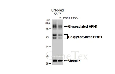 Anti-HRH1 antibody [HL3037] used in Western Blot (WB). GTX640475
