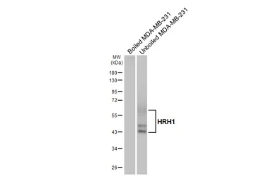 Anti-HRH1 antibody [HL3037] used in Western Blot (WB). GTX640475