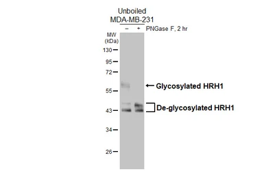 Anti-HRH1 antibody [HL3037] used in Western Blot (WB). GTX640475