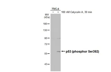 Anti-p53 (phospho Ser392) antibody [HL3047] used in Western Blot (WB). GTX640490