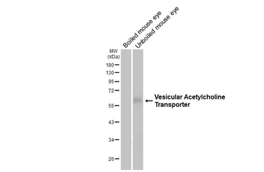 Anti-Vesicular Acetylcholine Transporter antibody [HL3053] used in Western Blot (WB). GTX640496