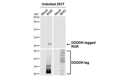 Anti-RGR antibody [HL3058] used in  (). GTX640501