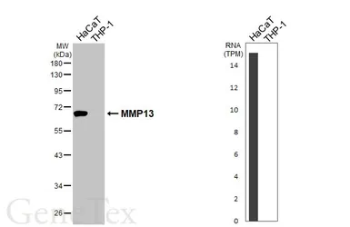 Anti-MMP13 antibody [HL3067] used in Western Blot (WB). GTX640513