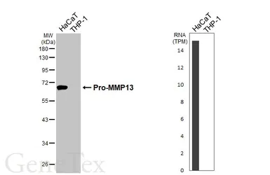 Anti-MMP13 antibody [HL3067] used in Western Blot (WB). GTX640513