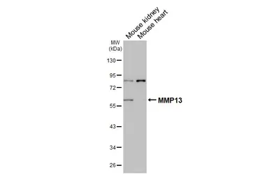 Anti-MMP13 antibody [HL3067] used in Western Blot (WB). GTX640513