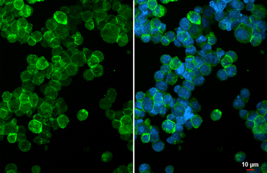 Anti-CCR7 antibody [HL3074] used in Immunocytochemistry/ Immunofluorescence (ICC/IF). GTX640520