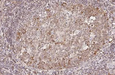 Anti-CCR7 antibody [HL3074] used in IHC (Paraffin sections) (IHC-P). GTX640520