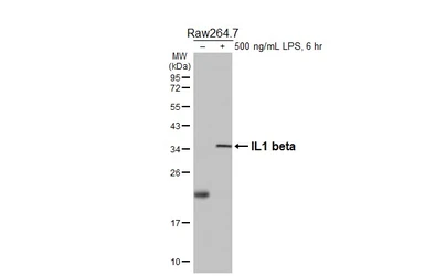 Anti-IL1 beta antibody [HL3084] used in Western Blot (WB). GTX640530