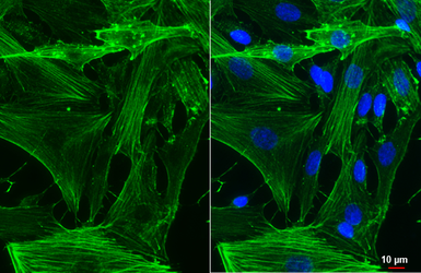 Anti-alpha Smooth Muscle Actin antibody [HL3085] used in Immunocytochemistry/ Immunofluorescence (ICC/IF). GTX640531