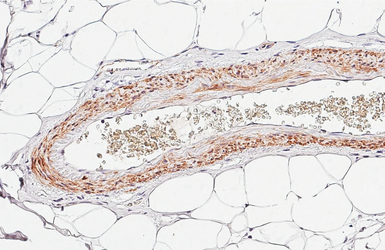 Anti-alpha Smooth Muscle Actin antibody [HL3085] used in IHC (Paraffin sections) (IHC-P). GTX640531