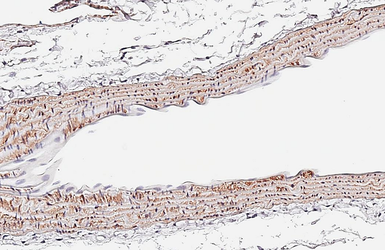 Anti-alpha Smooth Muscle Actin antibody [HL3085] used in IHC (Paraffin sections) (IHC-P). GTX640531