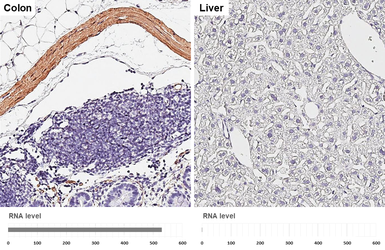Anti-alpha Smooth Muscle Actin antibody [HL3085] used in IHC (Paraffin sections) (IHC-P). GTX640531