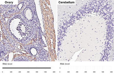 Anti-alpha Smooth Muscle Actin antibody [HL3085] used in IHC (Paraffin sections) (IHC-P). GTX640531