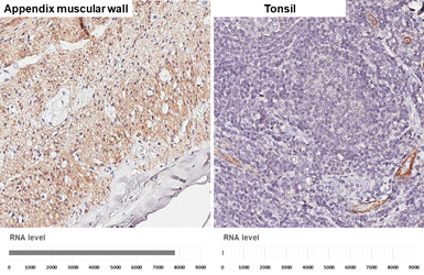 Anti-alpha Smooth Muscle Actin antibody [HL3085] used in IHC (Paraffin sections) (IHC-P). GTX640531
