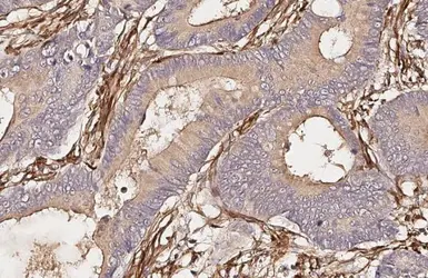 Anti-alpha Smooth Muscle Actin antibody [HL3085] used in IHC (Paraffin sections) (IHC-P). GTX640531