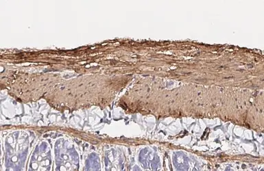 Anti-alpha Smooth Muscle Actin antibody [HL3085] used in IHC (Paraffin sections) (IHC-P). GTX640531