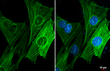 Anti-alpha Smooth Muscle Actin antibody [HL3088] used in Immunocytochemistry/ Immunofluorescence (ICC/IF). GTX640534