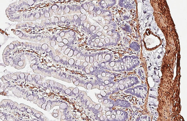 Anti-alpha Smooth Muscle Actin antibody [HL3088] used in IHC (Paraffin sections) (IHC-P). GTX640534