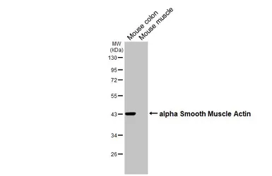 Anti-alpha Smooth Muscle Actin antibody [HL3088] used in Western Blot (WB). GTX640534