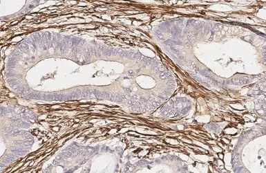 Anti-alpha Smooth Muscle Actin antibody [HL3088] used in IHC (Paraffin sections) (IHC-P). GTX640534