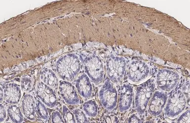 Anti-alpha Smooth Muscle Actin antibody [HL3088] used in IHC (Paraffin sections) (IHC-P). GTX640534