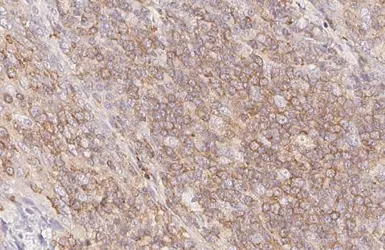 Anti-ARL13B antibody [HL3092] used in IHC (Paraffin sections) (IHC-P). GTX640538
