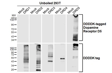 Anti-Dopamine Receptor D5 antibody [HL3100] used in  (). GTX640546