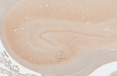 Anti-Dopamine Receptor D5 antibody [HL3100] used in IHC (Paraffin sections) (IHC-P). GTX640546