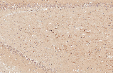 Anti-Dopamine Receptor D5 antibody [HL3100] used in IHC (Paraffin sections) (IHC-P). GTX640546