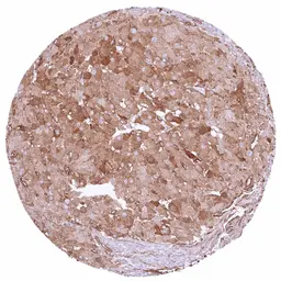 Anti-COL4A1 antibody [HMV327] HistoMAX&trade; used in IHC (Paraffin sections) (IHC-P). GTX640559