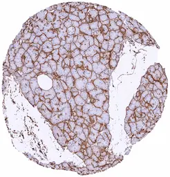 Anti-COL4A1 antibody [HMV327] HistoMAX&trade; used in IHC (Paraffin sections) (IHC-P). GTX640559