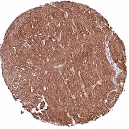 Anti-COL4A1 antibody [HMV327] HistoMAX&trade; used in IHC (Paraffin sections) (IHC-P). GTX640559