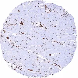 Anti-Mre11 antibody [HMV328] HistoMAX&trade; used in IHC (Paraffin sections) (IHC-P). GTX640560